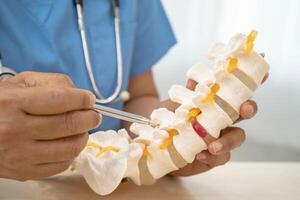 Doctor with lumbar vertebra bone skeleton and nerve model for treatment in the orthopedic department. photo