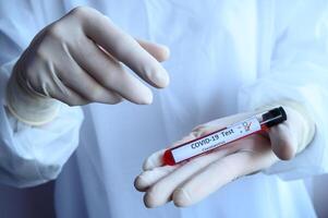 Close up of scientist doctor hand holding a sample test tube with blood for 2019-nCoV analyzing. photo