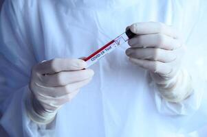 Close up of scientist doctor hand holding a sample test tube with blood for 2019-nCoV analyzing. photo