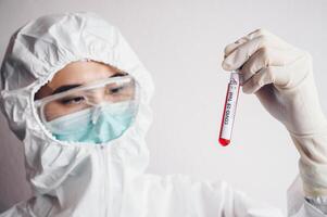 Doctor wearing PPE suit and holding a sample test tube with blood for 2019-nCoV analyzing. photo
