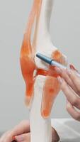 orthopédique spécialiste analyses imagerie résultats dans une moderne bureau, en utilisant une portable et le genou mixte modèle pour détaillé évaluation. vitrines Avancée orthopédique Diagnostique et consultation.vertical coup video