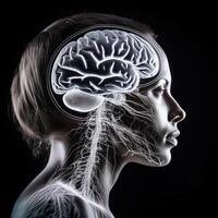 Human Brain Anatomy Visualization photo