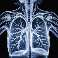 ct scan of the chest showing intricate XRAY photo
