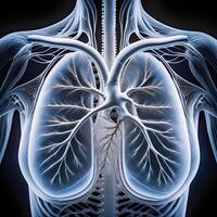 ct scan of the chest showing intricate XRAY photo
