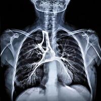 ct scan of the chest showing intricate XRAY photo