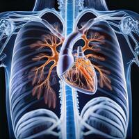 ct scan of the chest showing intricate XRAY photo