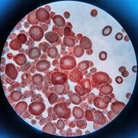 Microscopic Marvels Red Blood Cells Under the Microscope photo