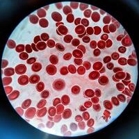 Microscopic Marvels Red Blood Cells Under the Microscope photo