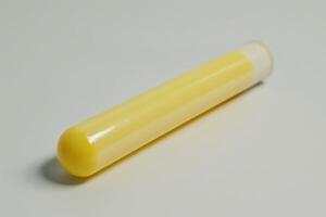 Yellow test tube with yellow liquid on a white surface in a laboratory setting photo