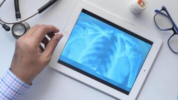 A man's hand is holding a tablet with a x-ray image on it video