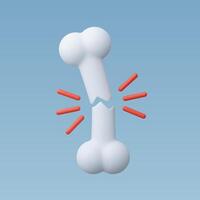3d Realistic Broken Bone fracture vector