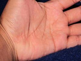 Closeup view of horizontal simian line on the palm of hand photo