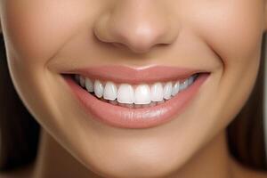 A woman with white teeth smiling photo