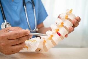Doctor with lumbar vertebra bone skeleton and nerve model for treatment in the orthopedic department. photo
