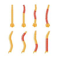 Comparing different human spine shapes with correct and incorrect posture, highlighting back pain areas vector
