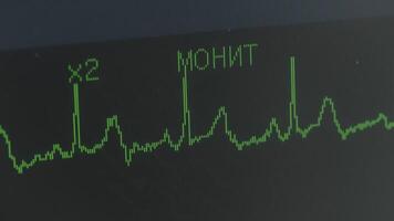 In the operating room. Action. A man lying in a hospital who is looking at an X-ray of a heartbeat and who was breathing through a special tube. video