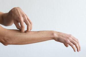 Dermatitis, eczema, allergy, psoriasis concept. man scratching itch on his arm, grey studio background. man itching rash on his elbow, copy space photo