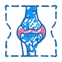 joint problem flat icon doodle illustration vector