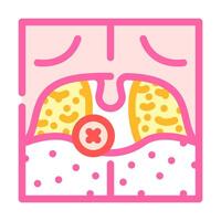 tonsillectomy surgery color icon illustration vector