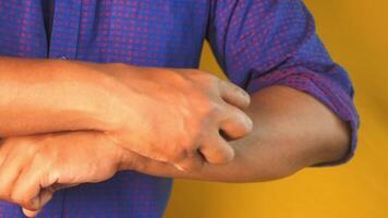 man suffering from itching skin, close up. video