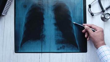 How to get a lung x-ray video