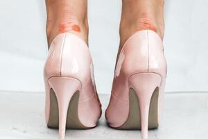 Legs of a girl with calluses in fashionable pink high-heeled shoes with a pointed toe photo