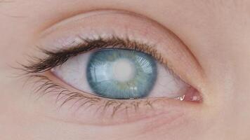 Cataract of human eye. Defect of transparency of the cornea video