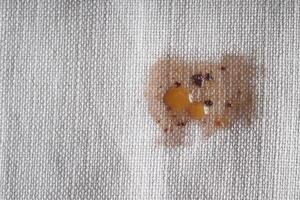 Fabric that is stained with an abstract pattern created by a food spill, showcasing art photo