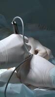 Close up of hands of surgeons team during operation with surgical laparoscopy instruments. Action. Team of surgeons at work in a hospital. video