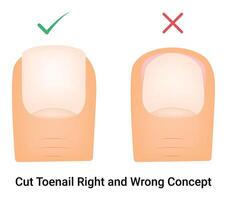 Cut Tonail Right and Wrong Concept Science Design Illustration Diagram vector