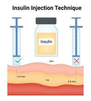 Insulin Injection Technique Science Design Illustration Diagram vector