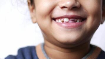 A close up of a child with a tooth missing video