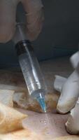 chirurgie opération proche en haut. action. mains de une médecin fabrication un injection pendant procédure. video