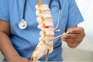 Doctor with lumbar vertebra bone skeleton and nerve model for treatment in the orthopedic department. photo