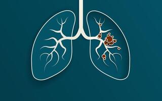 Simple 3D Paper Cut out Illustration of the human lungs. Left lung popped out above surface with shadow, right lung hollowed into background with floating lung bronchus and red tumor cells. vector