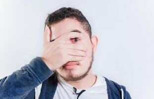 Unhappy man with conjunctivitis isolated. Person with irritated eyes looking at camera photo