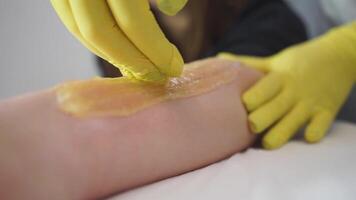 Shugaring wax epilator. Removing hair from the skin of a woman's hand using a thick wax mixture video