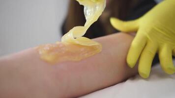 Shugaring wax epilator. Removing hair from the skin of a woman's hand using a thick wax mixture video