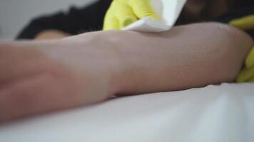 Shugaring wax epilator. Removing hair from the skin of a woman's hand using a thick wax mixture video
