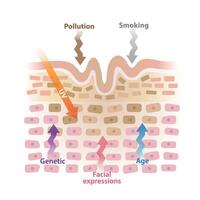 Cause of wrinkles on skin layer illustration isolated on white background. Age, ultraviolet radiation, smoking, pollution, facial expressions, genetic causes lines and creases to form on skin. vector