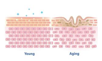 Comparison of young and aging skin illustration isolated on white background. Cross section of healthy and wrinkle that lose strength, flexibility and firmness on structure skin layer. vector