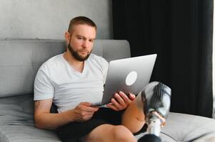 Man amputee with prosthetic leg disability on above knee transfemoral leg prosthesis artificial device using laptop at home. People with amputation disabilities everyday life photo