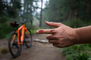 Closeup of hand with cut finger, blurred forested background, orange bicycle nearby photo
