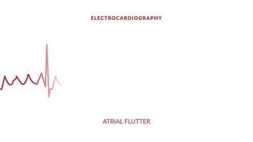 animated atrial flutter. animated ekg display video