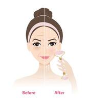 Before and after use jade roller massage tool on woman face illustration on white background. Reduce puffiness, wrinkles, dark circle under eyes, tighten pores size, improve elasticity of skin. vector
