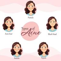 Decoding Acne A Comprehensive Guide to Different Types and Effective Treatments vector