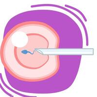 Ivf procedure illustration with purple background. Fit for science presentation. vector