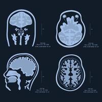 X-ray images of the brain, scanned with MRI or CT. Accept radiology vector