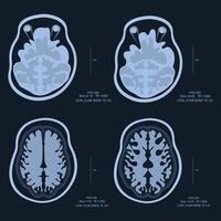 MRI - Magnetic Resonance Imaging - Illustration. X-ray images of the brain vector