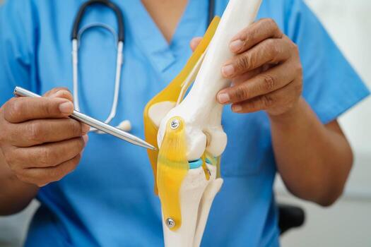Knee osteoarthritis, Doctor showing model knee joint orthopedic. photo
